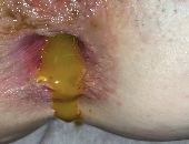 Poopee79