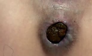 Close up pooping