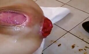 Plug scat prolapse fist